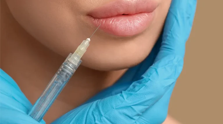 Lip Dissolving-1 Lip Dissolving-1